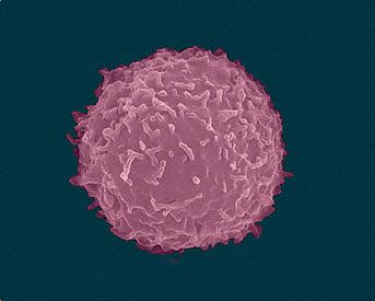 T细胞有病：为何类风湿性关节炎发作部位总是同一处插图
